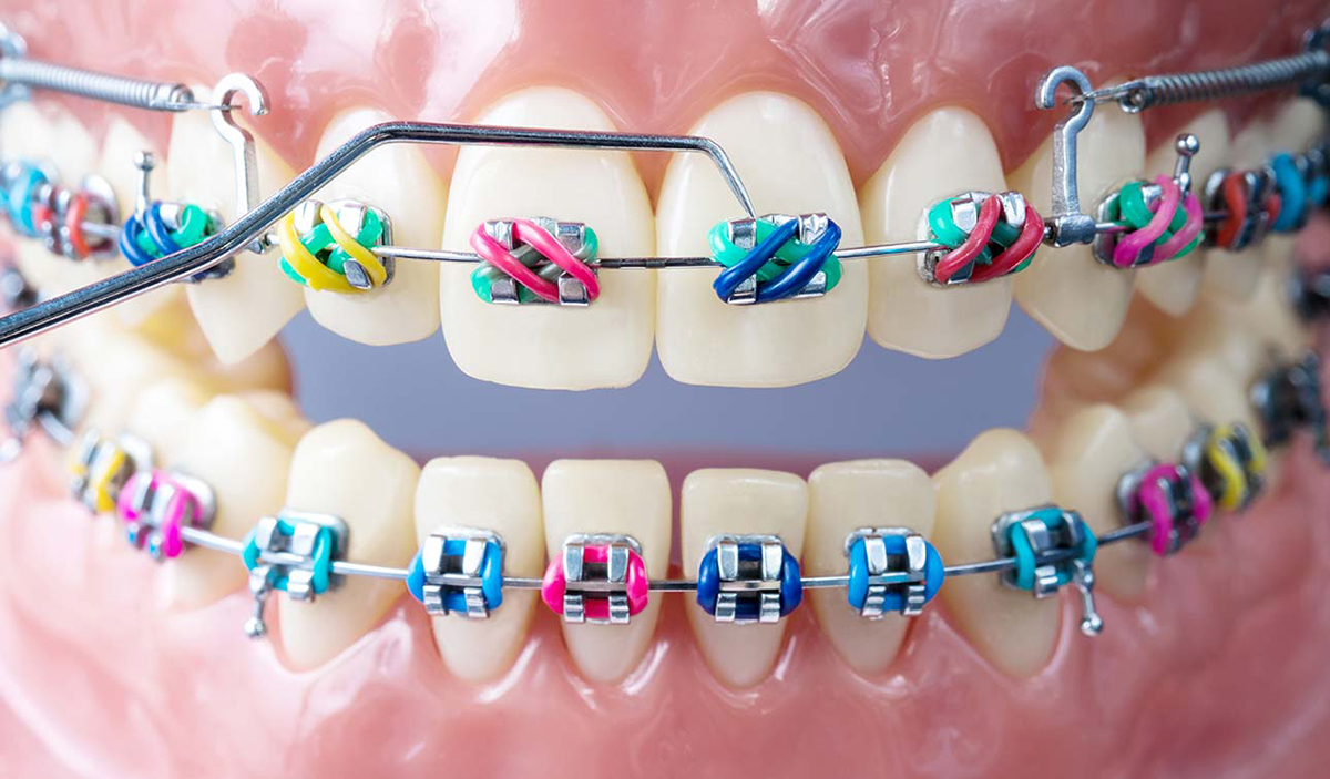 Orthodontics