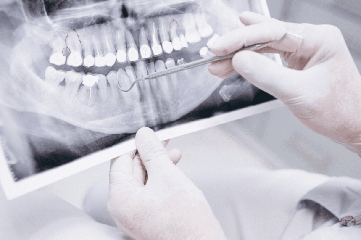 X-Ray